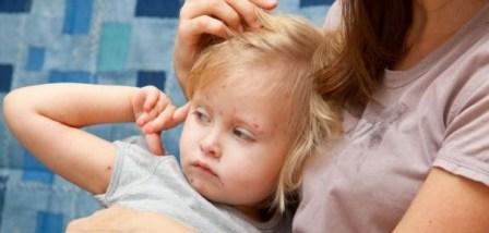 Вітрянка у дітей: симптоми, лікування, інкубаційний період